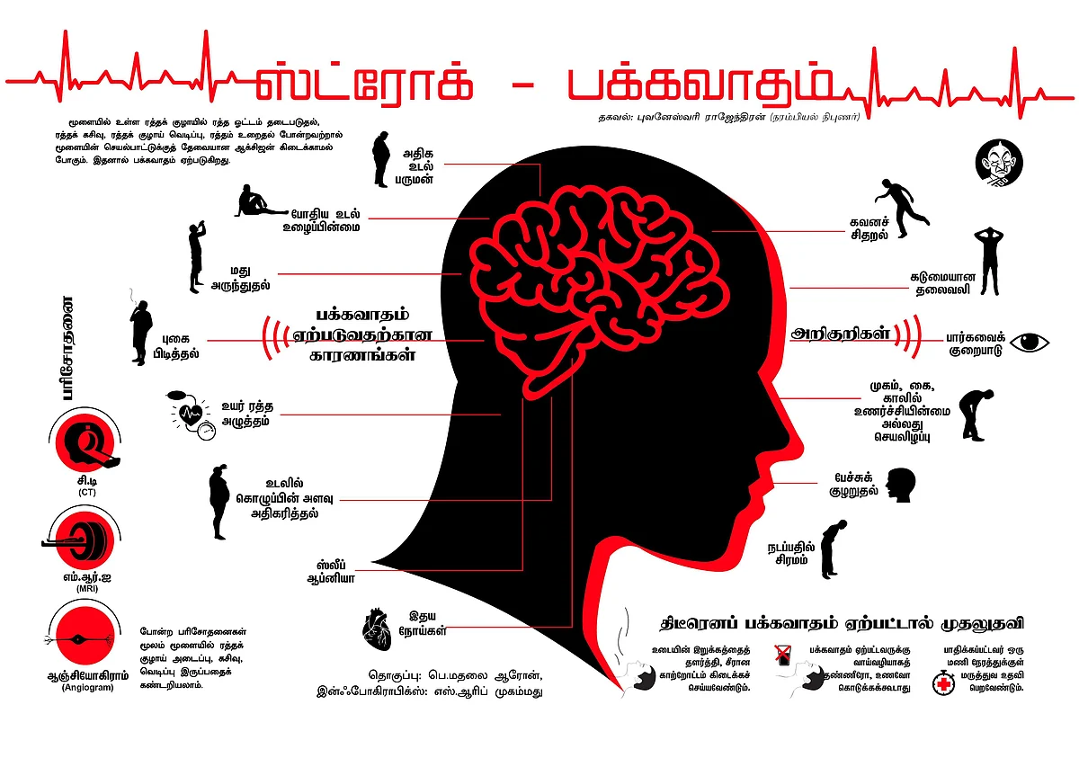 `புகைபிடிப்பவர்களுக்கு இரண்டாவது முறை 'ஸ்ட்ரோக்' ஏற்பட வாய்ப்புகள் அதிகம்!' - எச்சரிக்கும் புதிய ஆய்வு