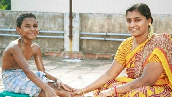 வெயில் காலத்தில் வதைக்கும் 'மூலம்' - தற்காத்துக்கொள்ளும் வழிமுறைகள்!