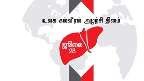 உலக கல்லீரல் அழற்சி தினம்