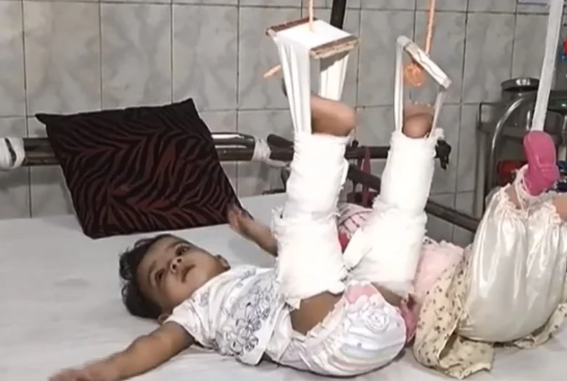 CHILD Under treatment