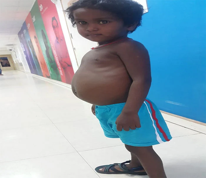 தாயின் கல்லீரல் இருக்கிறது, ஆபரேஷனுக்கு பணம்தான் இல்லை!
