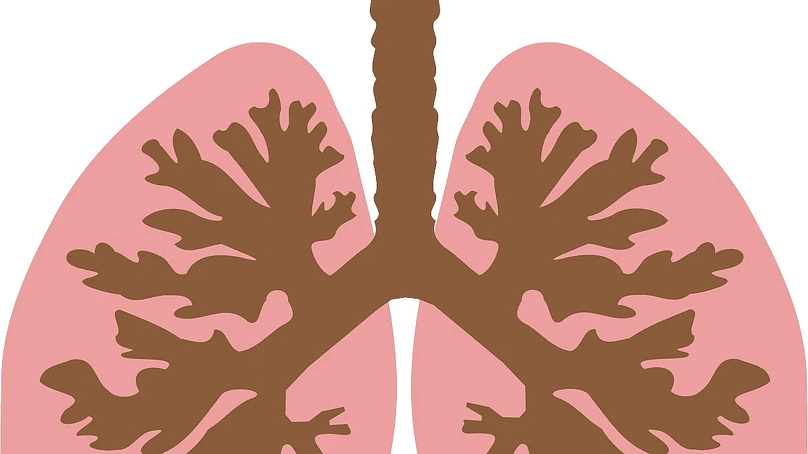 Tuberculosis