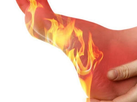 Feet Burn – Symptoms & Causes