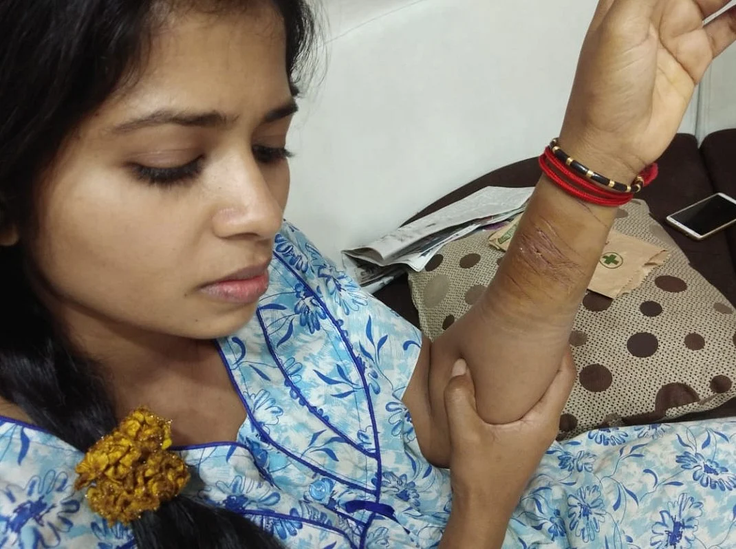 கையில் ஏற்பட்ட காயத்துடன் மதுமிதா