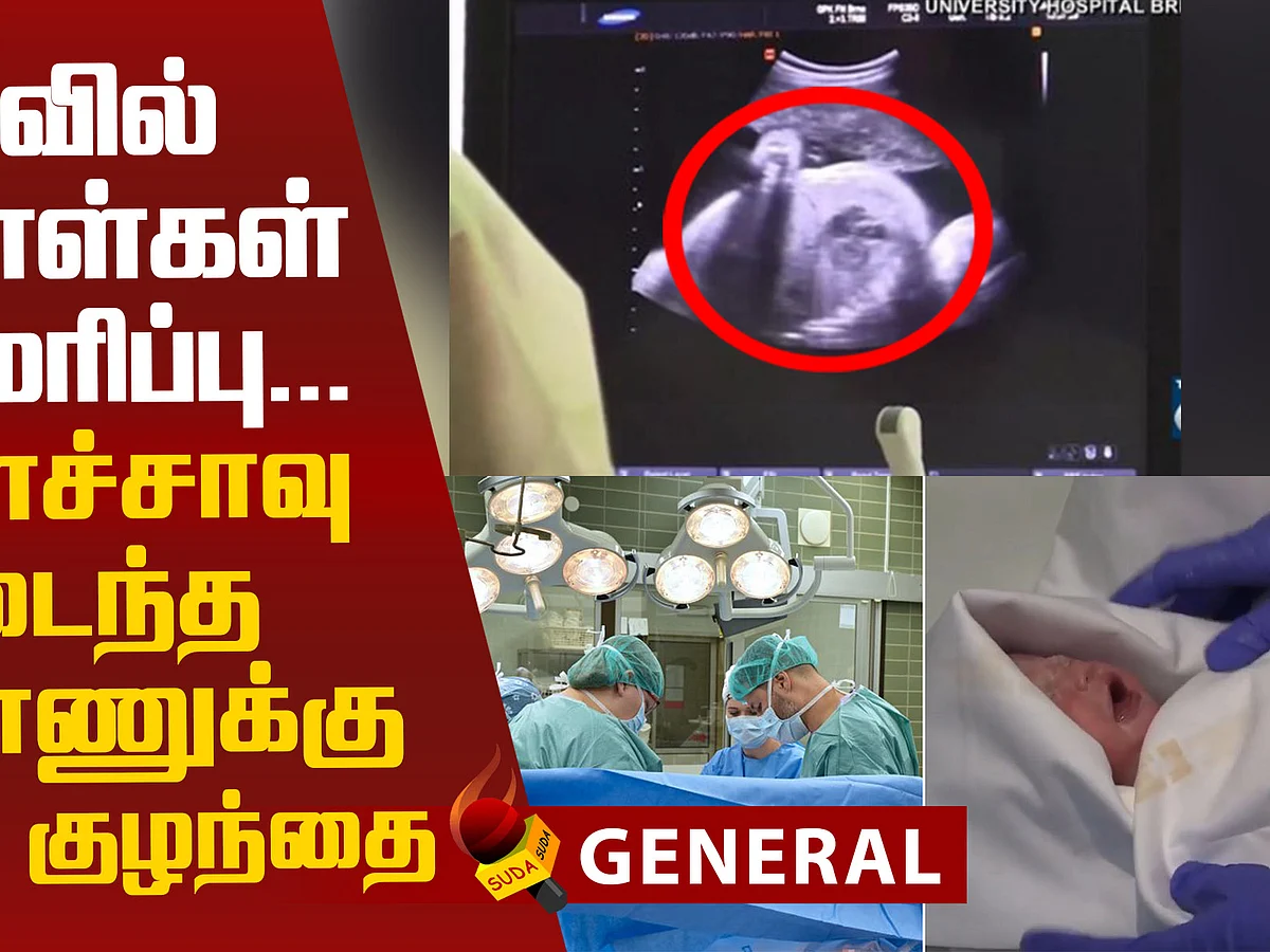 Baby born to brain-dead mother in the Czech Republic!