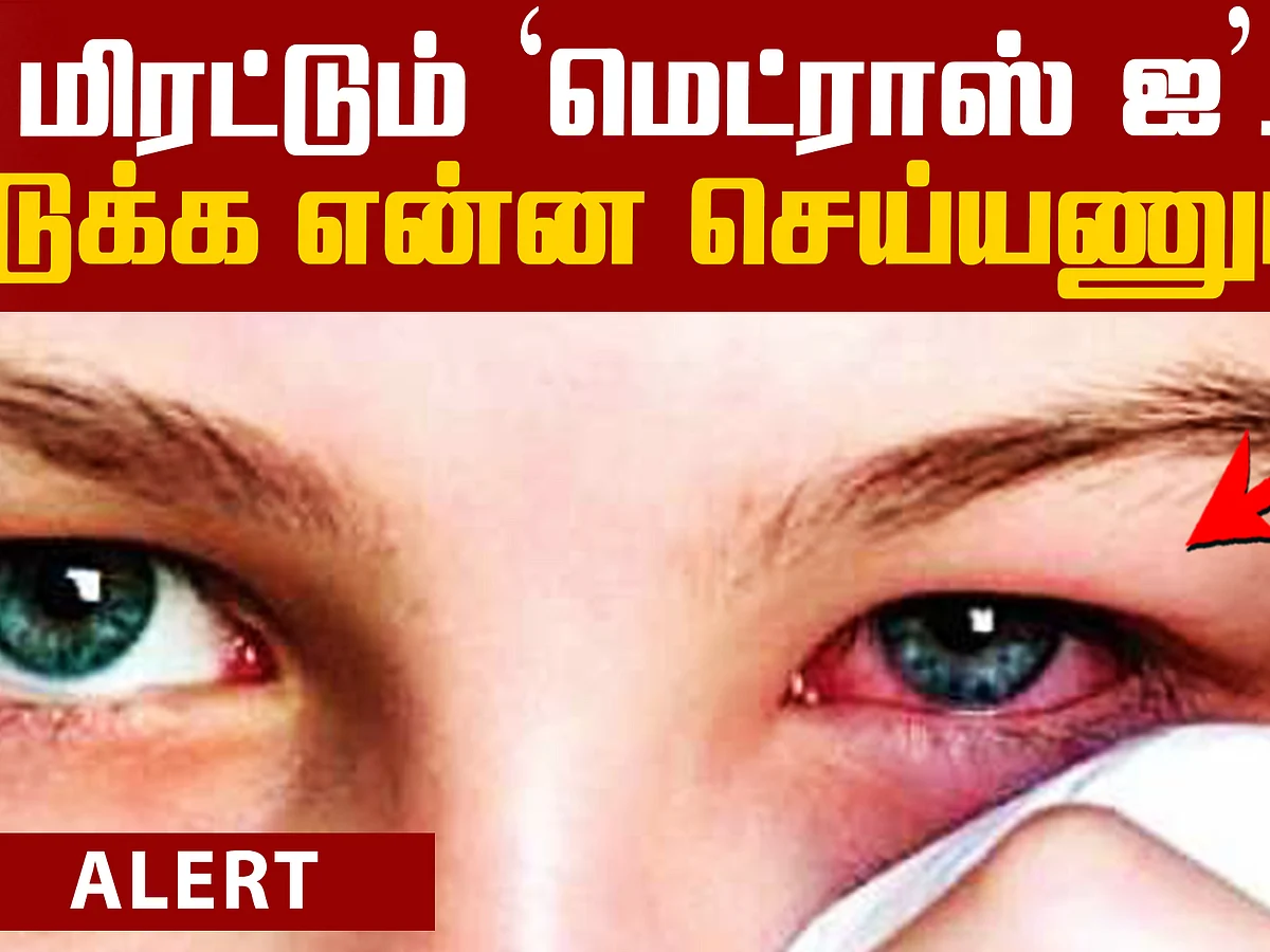 Precaution & Symptoms for Pinkeye (Conjunctivitis)