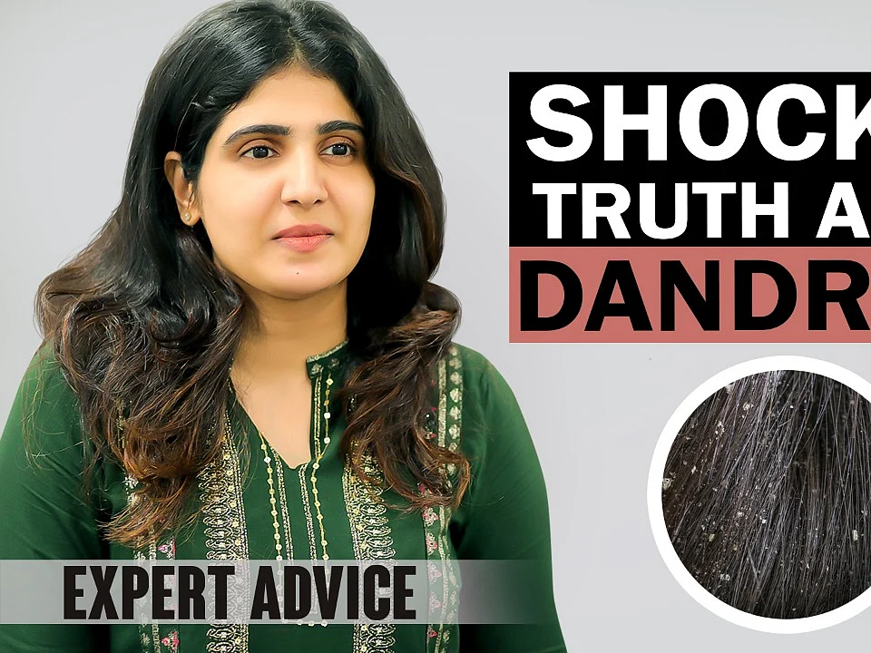 Tips to reduce Dandruff!