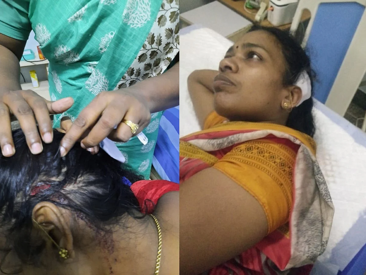 காயமடைந்த டைப்பிஸ்ட் சாரதி