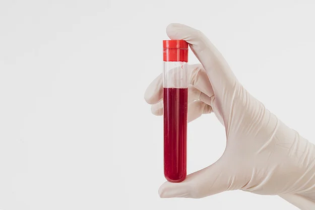 Blood Test