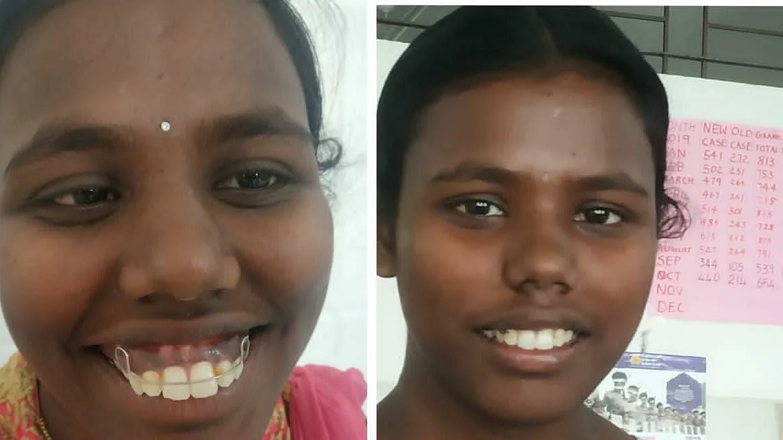 சண்முகப்பிரியா சிகிச்சைக்கு முன்னும் பின்னும்