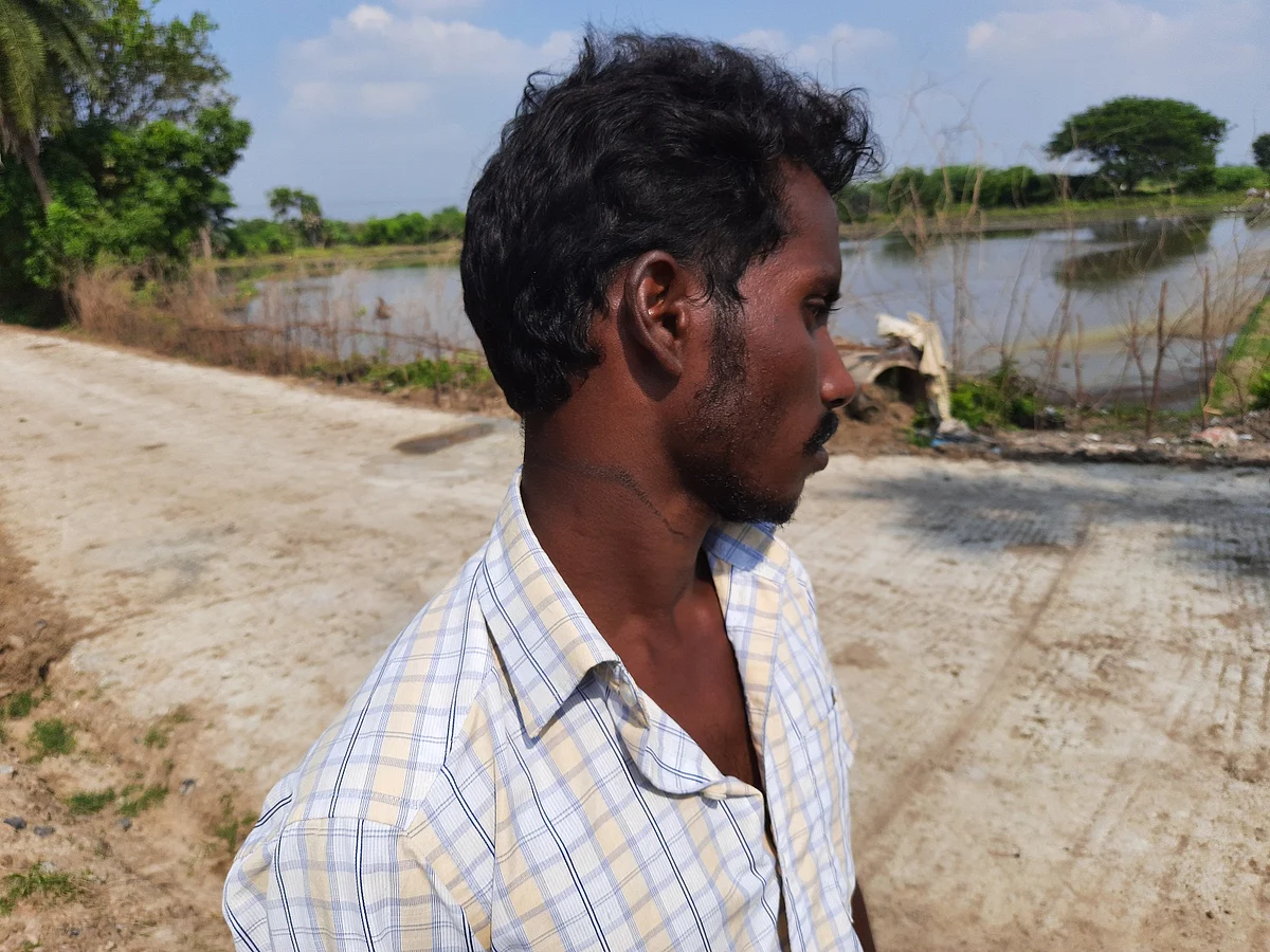 அமரன் கழுத்தில் காயம்