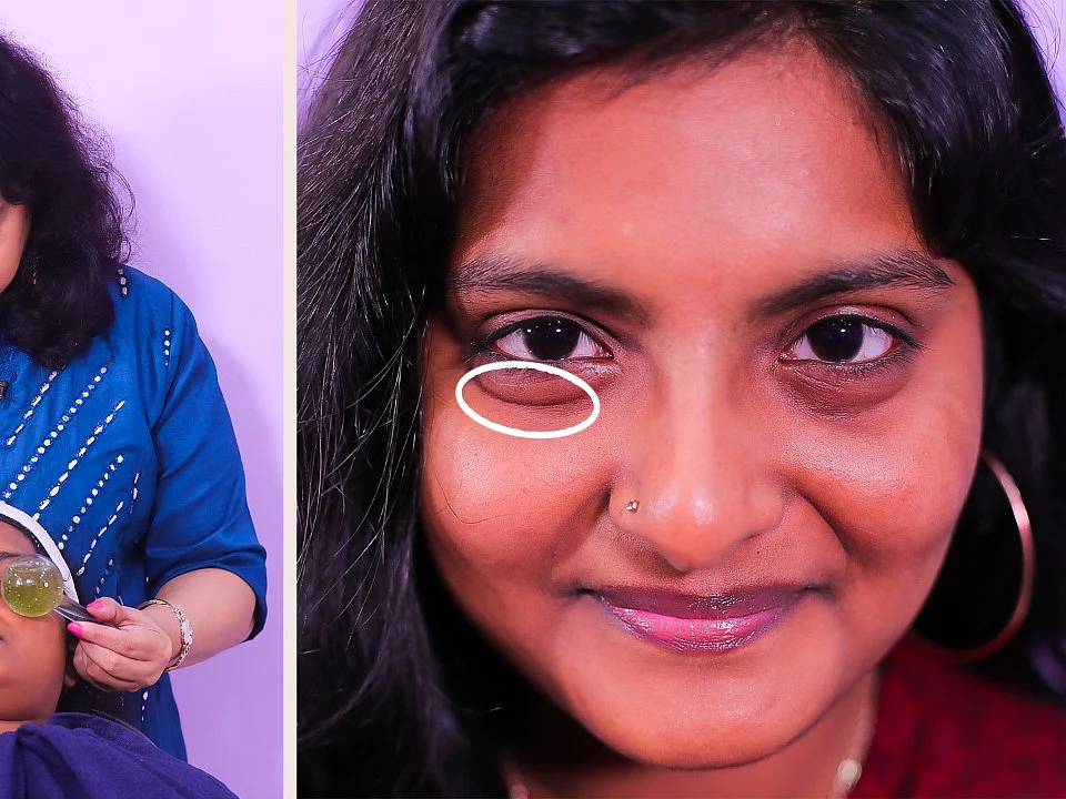 Make your eye bags disappear in 10 mins | homemade eye mask | Vasunthara series #Undereyebags