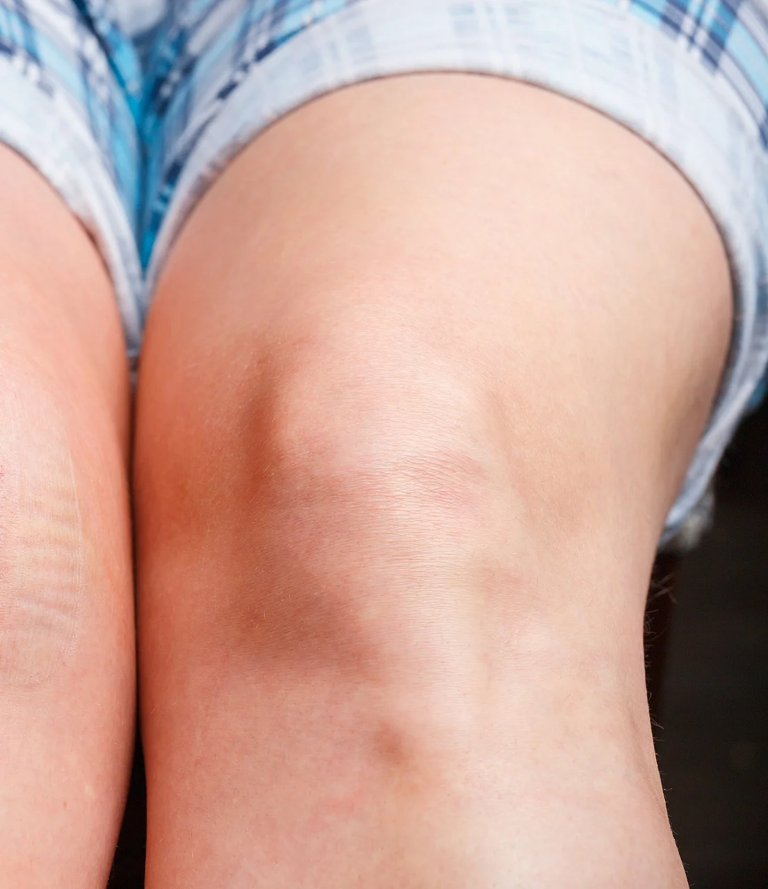 Dark Knee problem