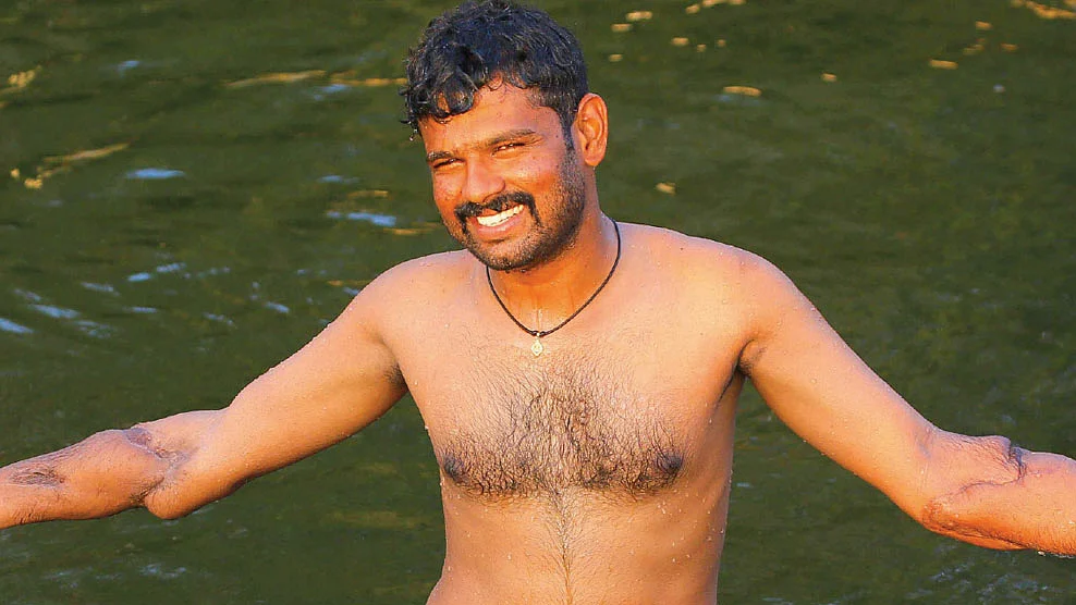 கைமாற்று அறுவை சிகிச்சைக்குப் பின்