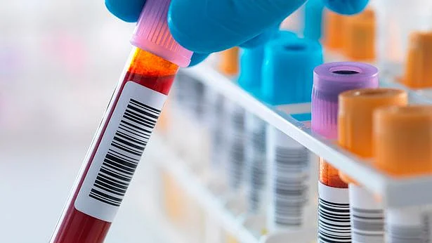 Blood samples