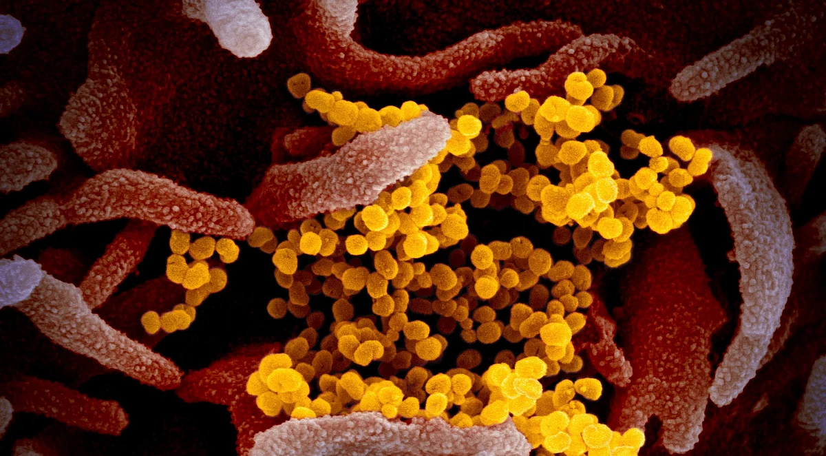 Novel Coronavirus SARS-CoV-2