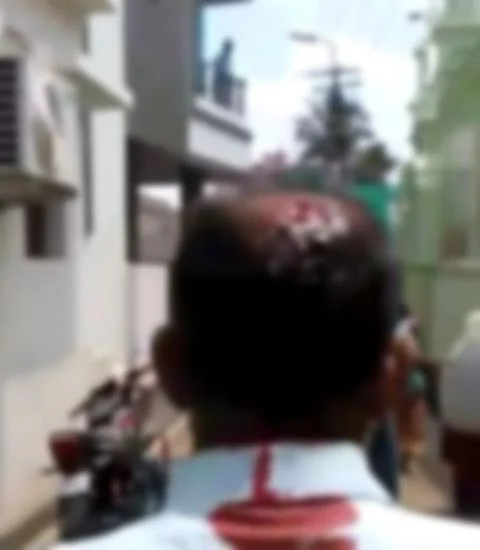 ரத்தக் காயத்துடன் ஓடிய நபர்