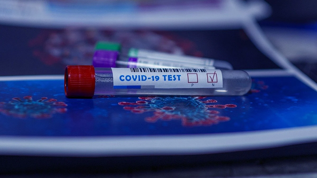 Covid 19 Test