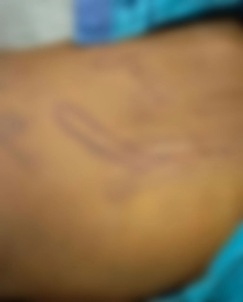 சிறுவன் உடலில் காயங்கள்