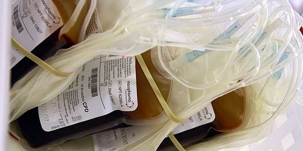 Plasma treatment (Representational Image)