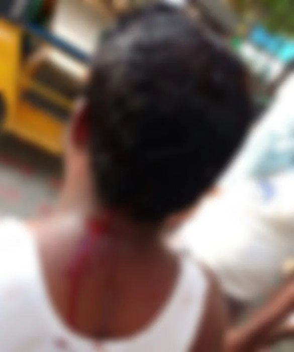 வெட்டுக் காயம் அடைந்தவர்
