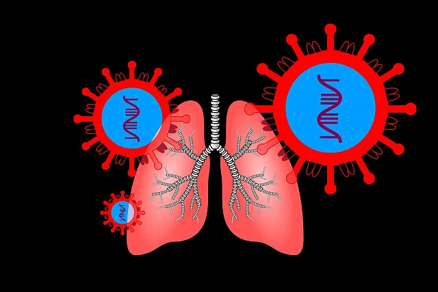 Tuberculosis