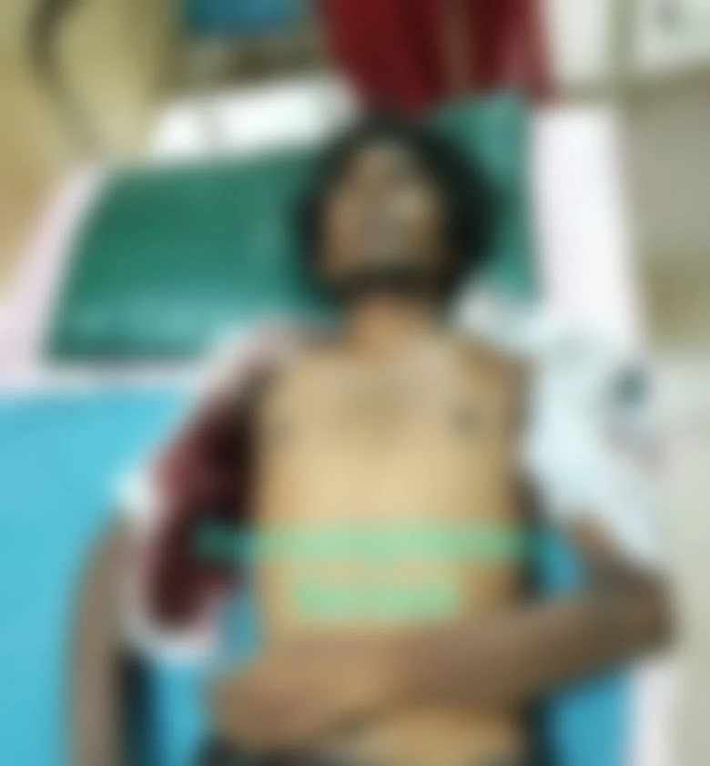 சடலமாக ரமேஷ்