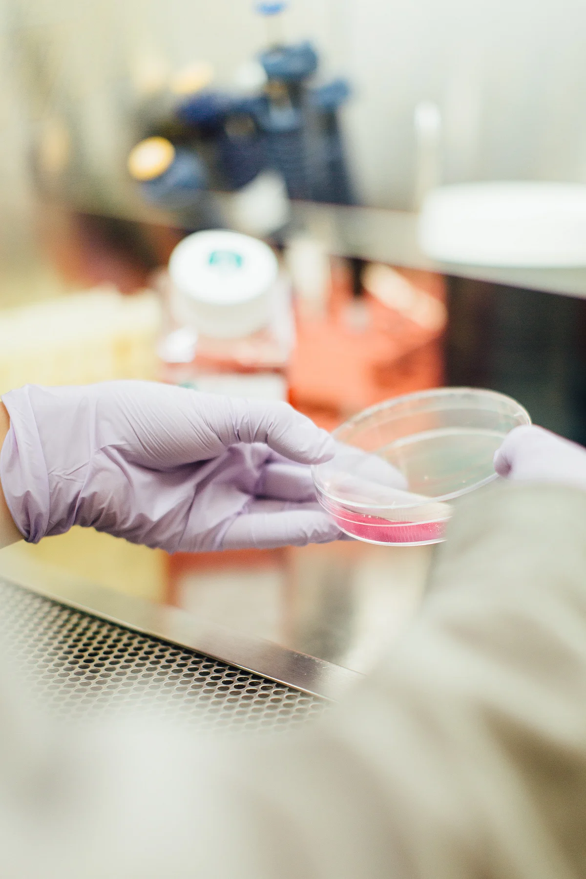 Lab Tests
