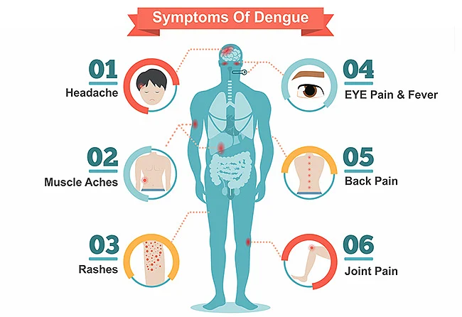 symptoms of dengue