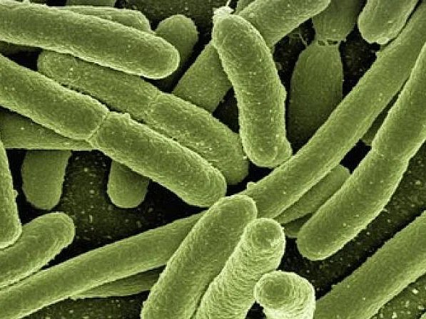 Bubonic Plague