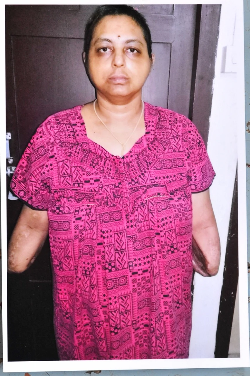 கைகள் நீக்கப்பட்ட தருணத்தில் லிங்கசெல்வி