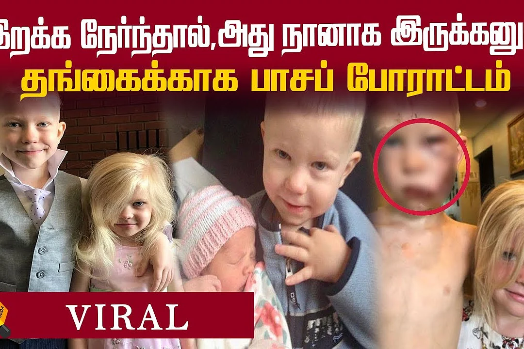 Viral