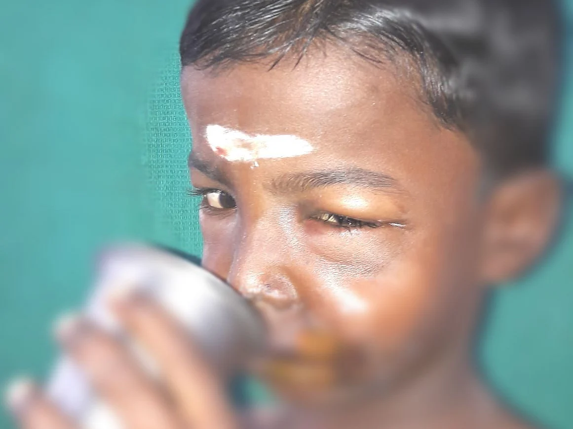 நாட்டு வெடிகுண்டைக் கடித்த சிறுவன்! - 4 மணிநேரத்தில் முகத்தை சீரமைத்த அரசு மருத்துவர்கள்
