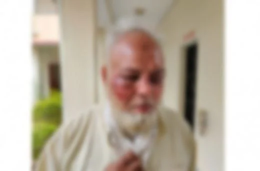 தாக்கப்பட்ட நபர்