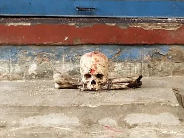 பழநி: `வீட்டு வாசலில் மண்டை ஓடுகள்; போதை இளைஞர்களின் வேலையா?’ - அச்சத்தில் மக்கள்