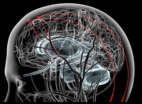 Neuralink’s N1 chip