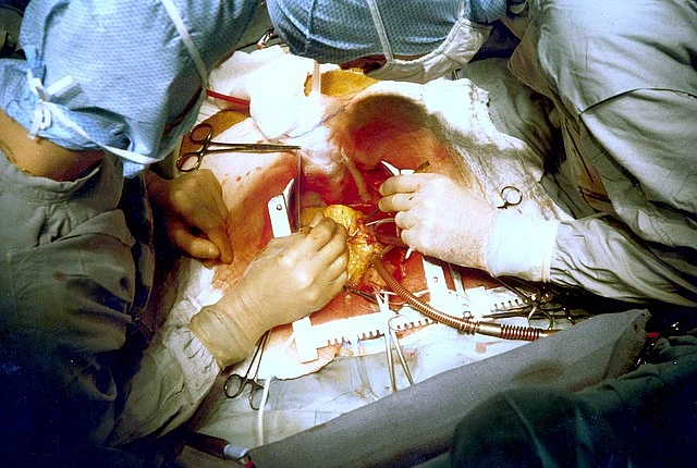 Surgery