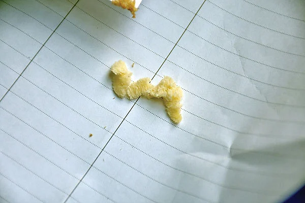 முட்டை தொகுப்பு