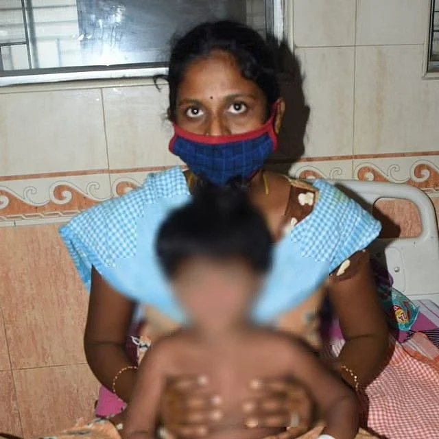 டாக்டர்கள் குழு சிகிச்சையளித்த குழந்தை