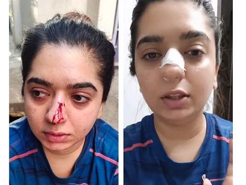 பெங்களூரு: ஸொமேட்டோ ஊழியரால் தாக்கப்பட்ட பெண், வைரலான வீடியோ... என்ன நடந்தது?