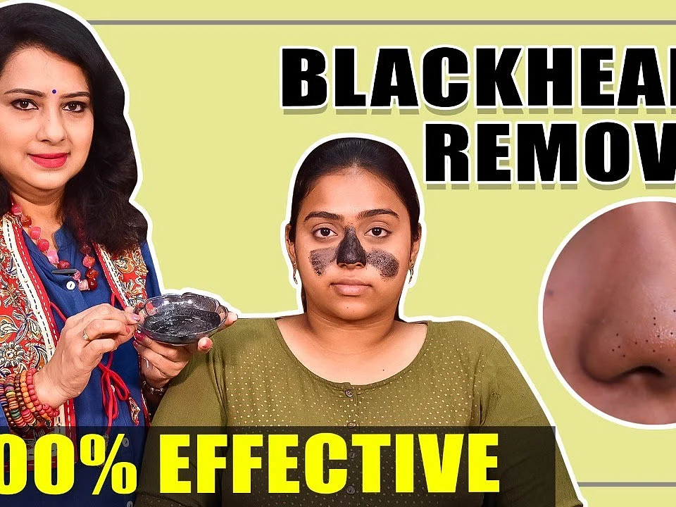 Blackheads-க்கு நிரந்தர தீர்வு! | Natural Home Remedies | Vasundhara Tips | Say Swag