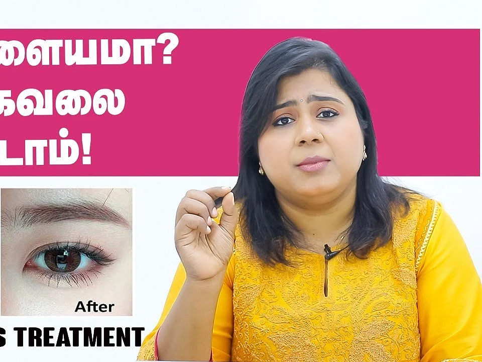 கருவளையத்தைப் போக்குவது எப்படி? | Tips, Natural Remedies & Treatment for dark circles