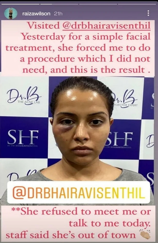 Raiza's Insta Story