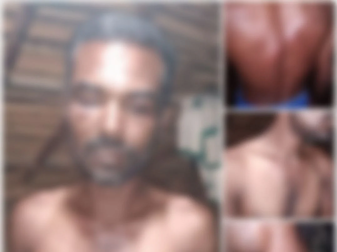 சேலம்:``சாதியைச் சொல்லி நிர்வாணப்படுத்தி அடிச்சாங்க"- பட்டியல் சமூகத்தைச் சேர்ந்தவர் மீது தாக்குதல்