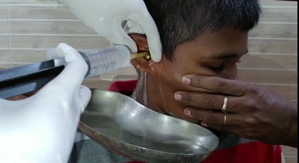 கோவை சிறுவன் காதில் குண்டு