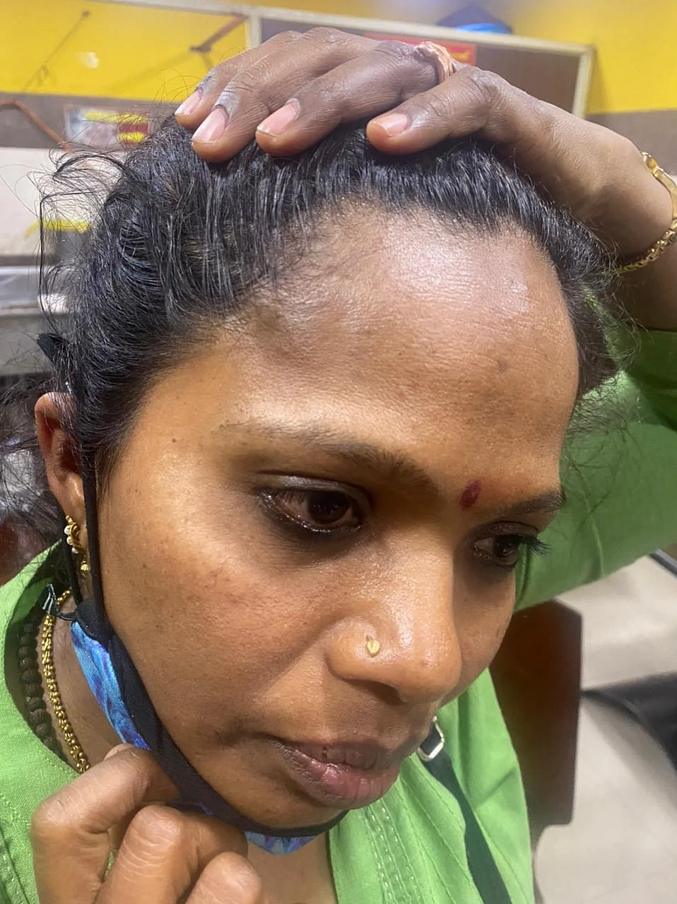 பெண் காயம்