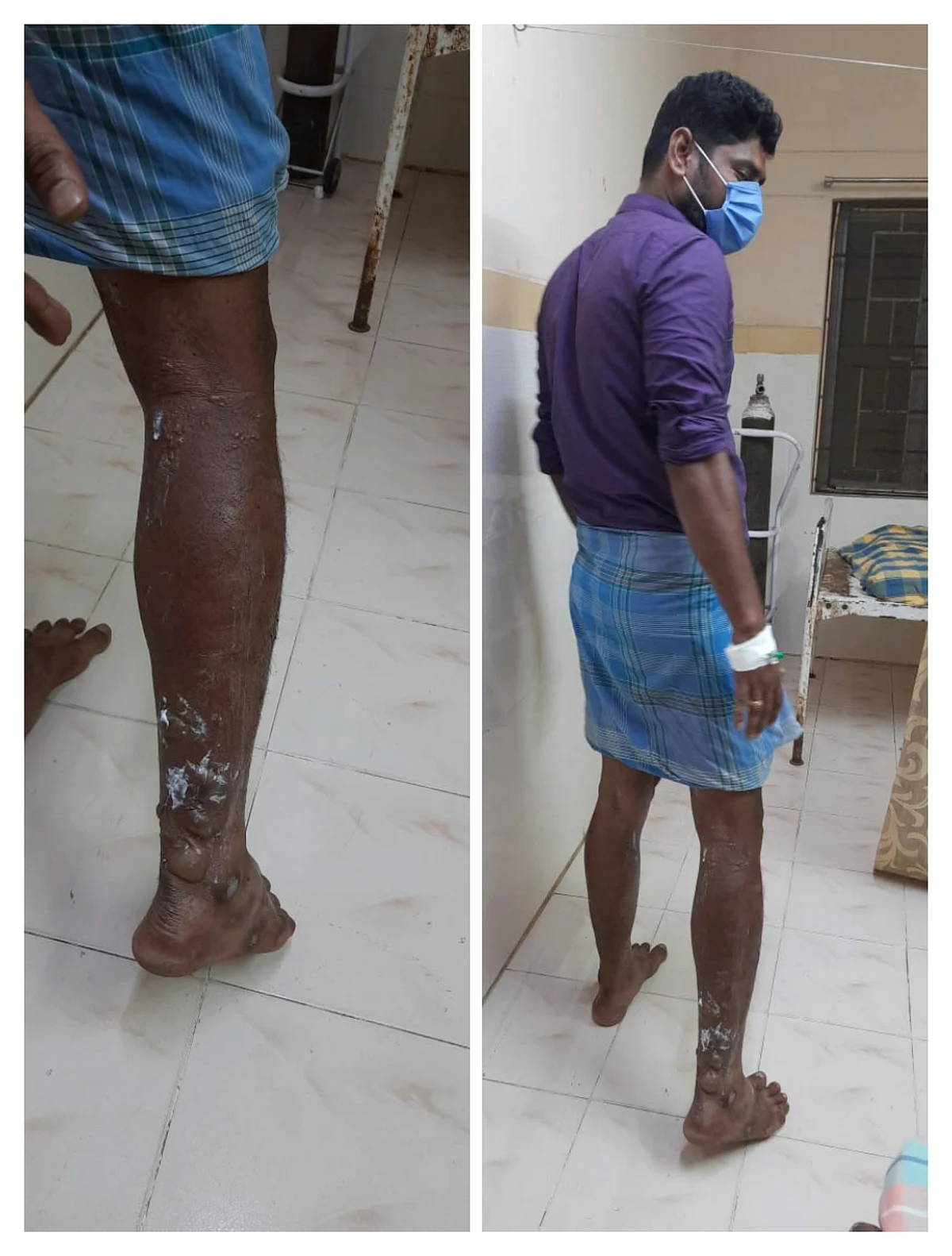 பெட்ரோல் குண்டுவீச்சு