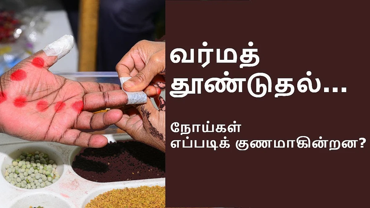 வர்மப் புள்ளிகள்