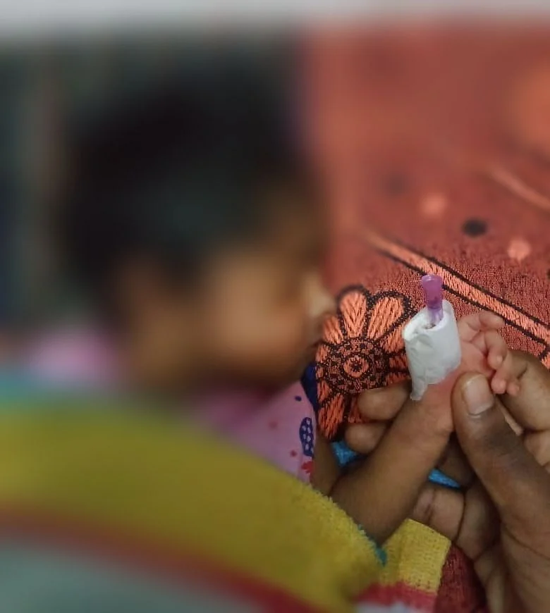 கட்டை விரல் துண்டானதாகச் சொல்லப்படும் குழந்தை