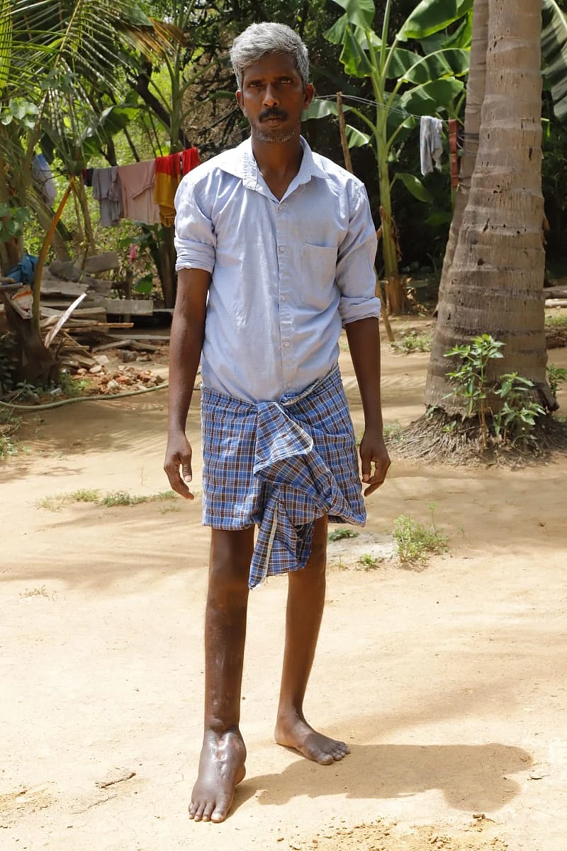 சிகிச்சை முடிந்து டிஸ்சார்ஜ் செய்யப்பட்ட பிறகு...